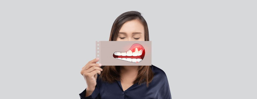 Oral Cancer: Importance of Early Diagnosis and Treatment